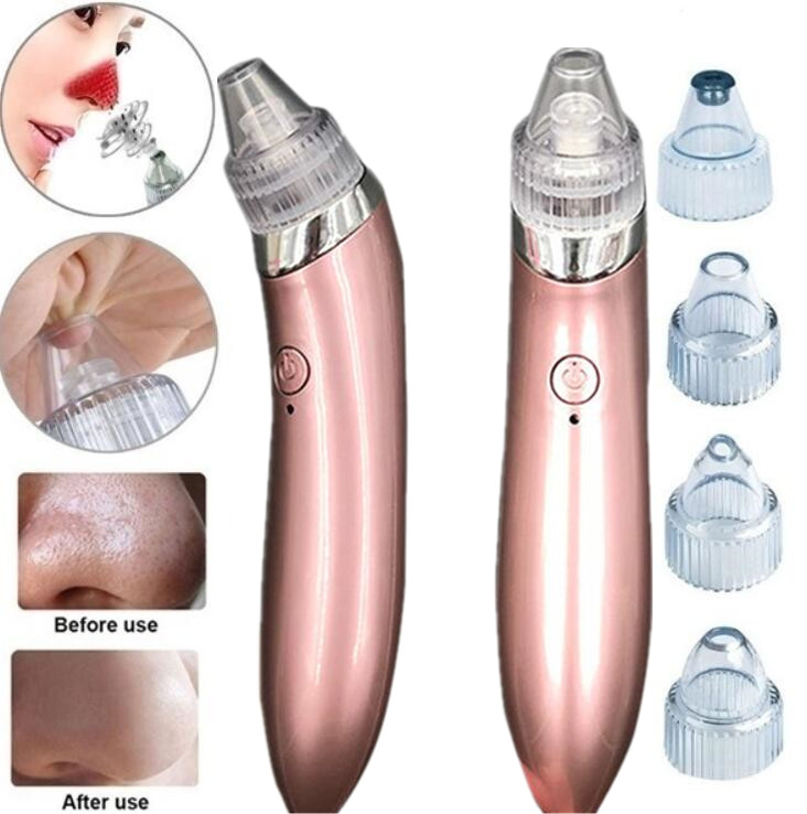 Extractor de Puntos Negros